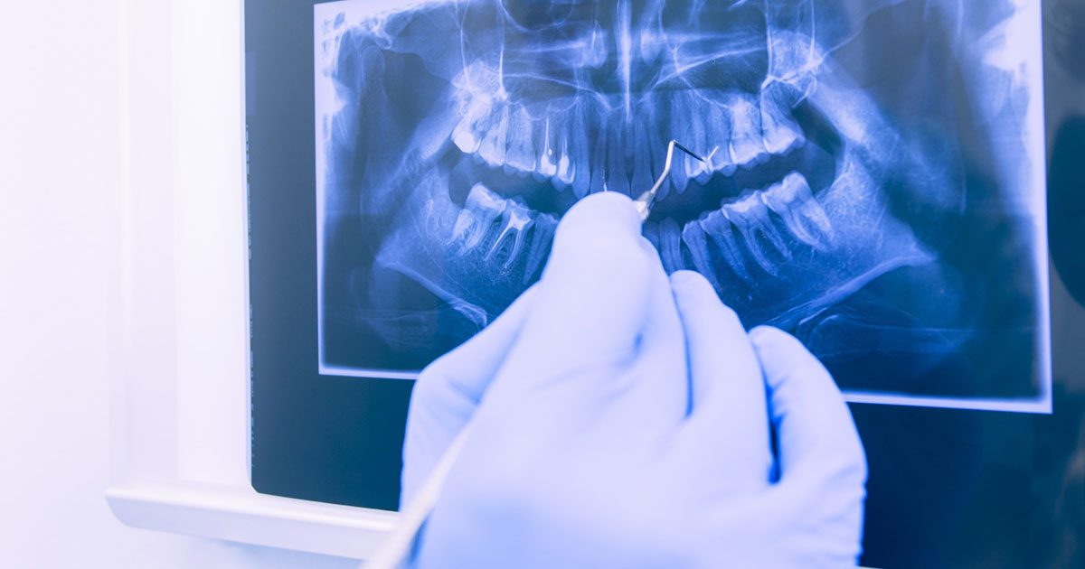 Image of dental xray being examined by an orthodontist.