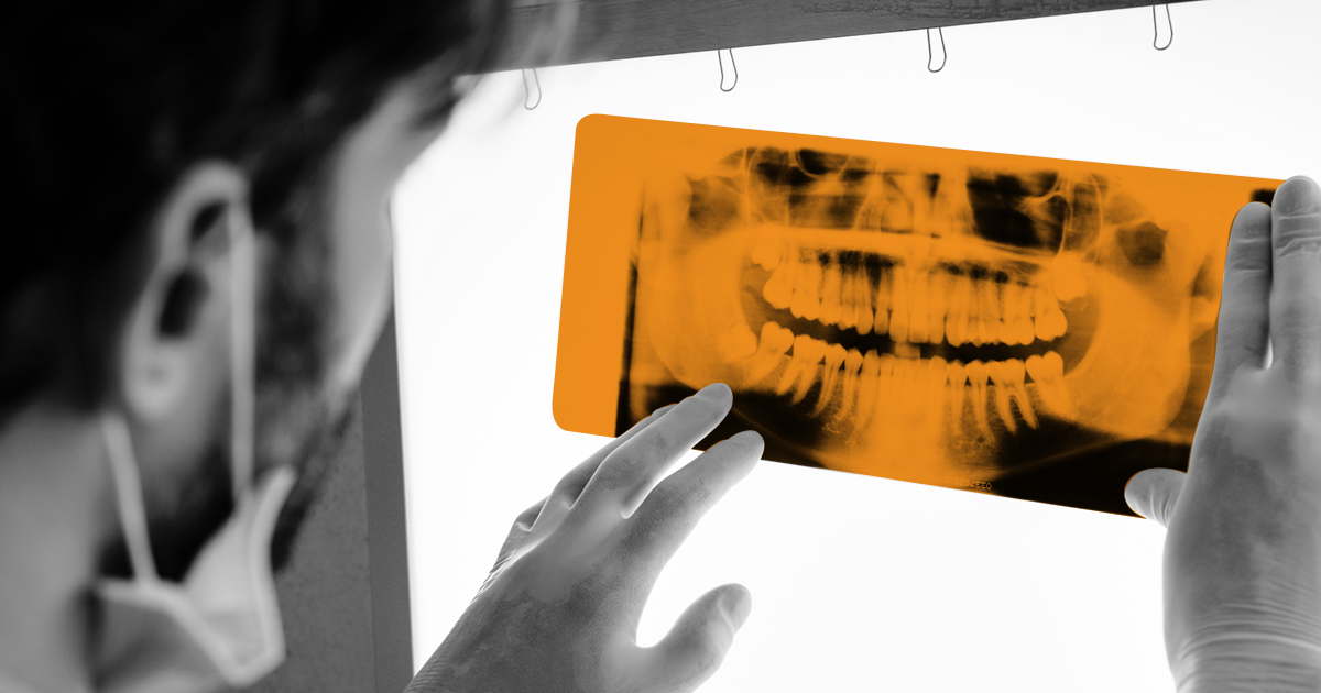 Image of NHS Dentist looking at an xray of teeth.